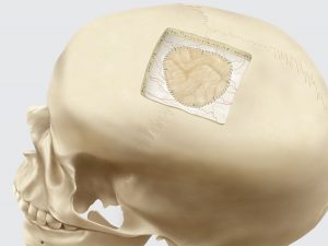 Biodesign Dural Graft 